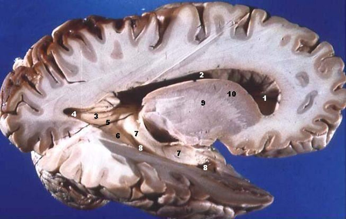 Anatomie de la barrière hémato encéphalique Domaines du cerveau sans