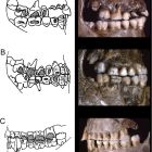 Il y a 30 000 ans, ces européens portaient des piercings aux joues