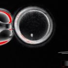 ì Transformer des cellules de peau en ovules: espoir pour les couples infertiles ou homosexuels