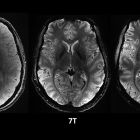 ì Le cerveau dévoilé comme jamais grâce à l'IRM le plus puissant au monde