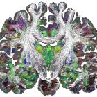Cette nouvelle cartographie du cerveau profond révèle les détails de son architecture à