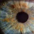 A Un implant sous-rétinien restaure partiellement la vision de personnes atteintes de DMLA