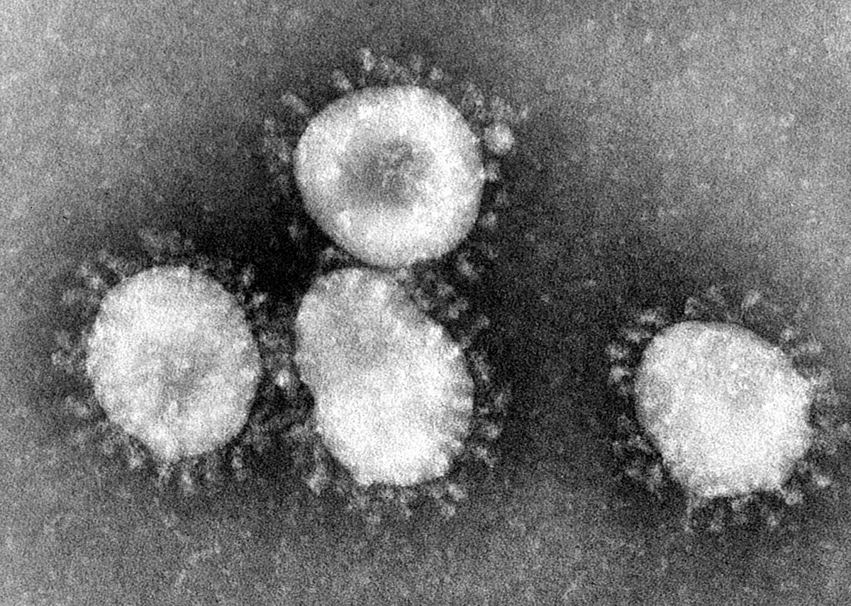  Coronavirus sp.