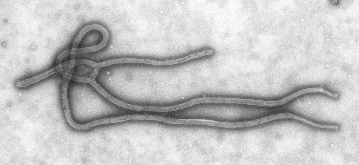  Virus Ebola (au microscope électronique en transmission)