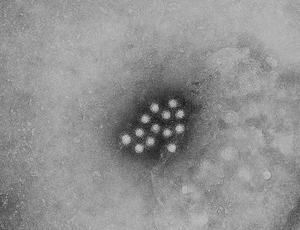  Virus de l’hépatite A au microscope électronique