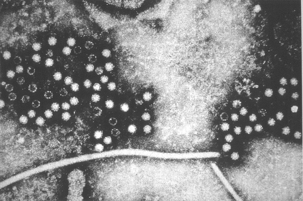  Virus de l’hépatite E au microscope électronique