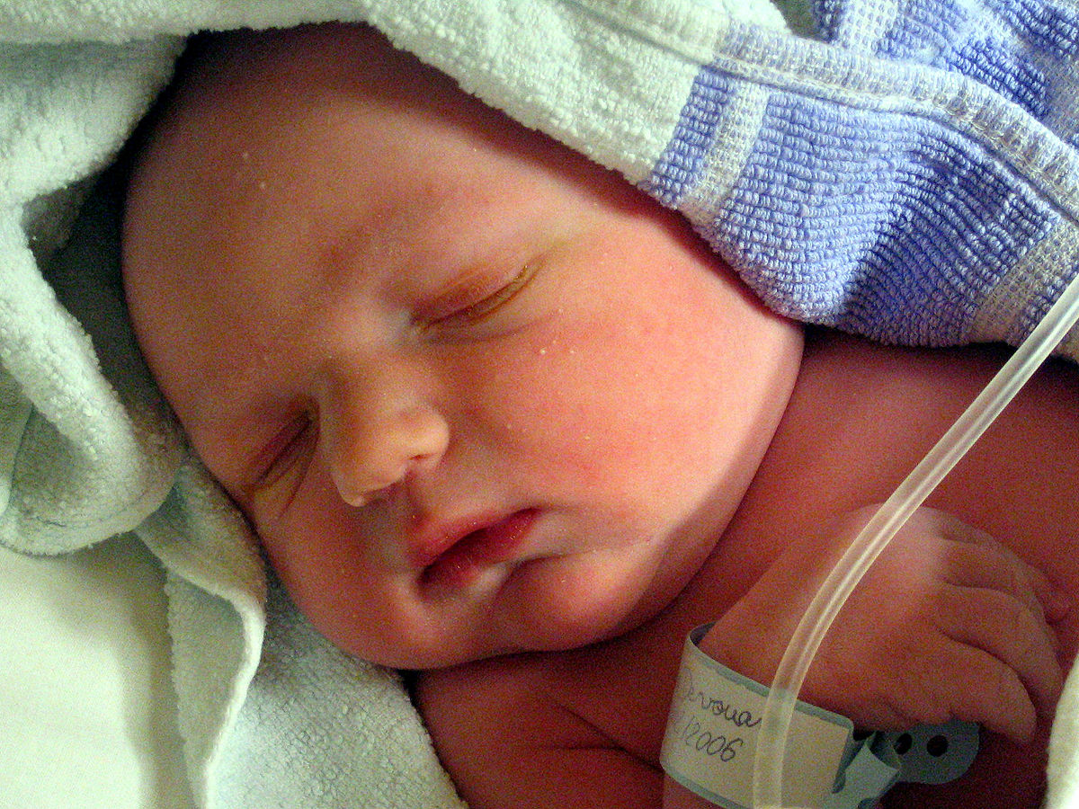 Image montrant un nouveau-né 10 minutes après la naissance. Il a été étiqueté et traité contre l'infection des yeux immédiatement après l'accouchement.