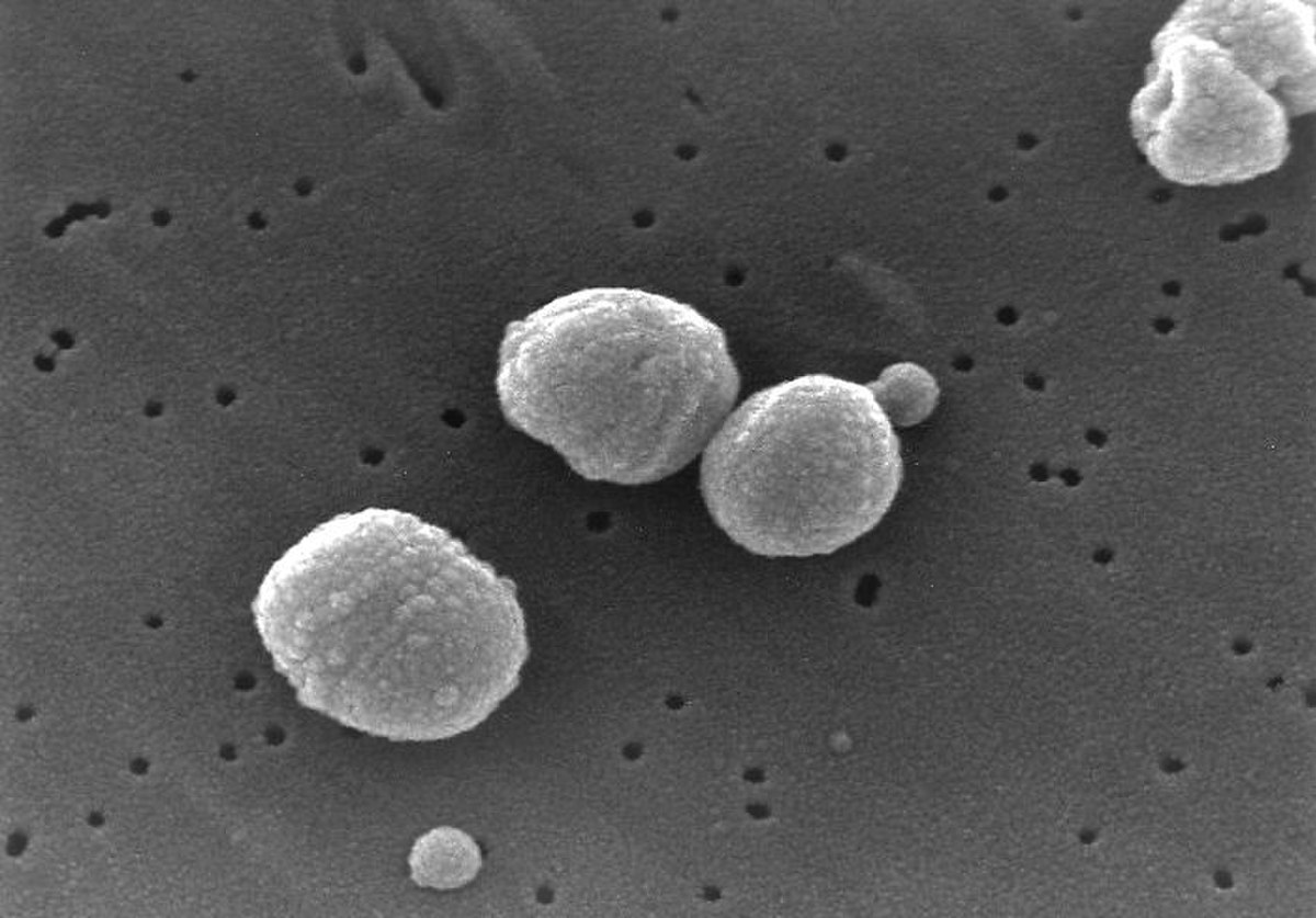 Streptococcus Pneumoniae Définition Et Explications 6211