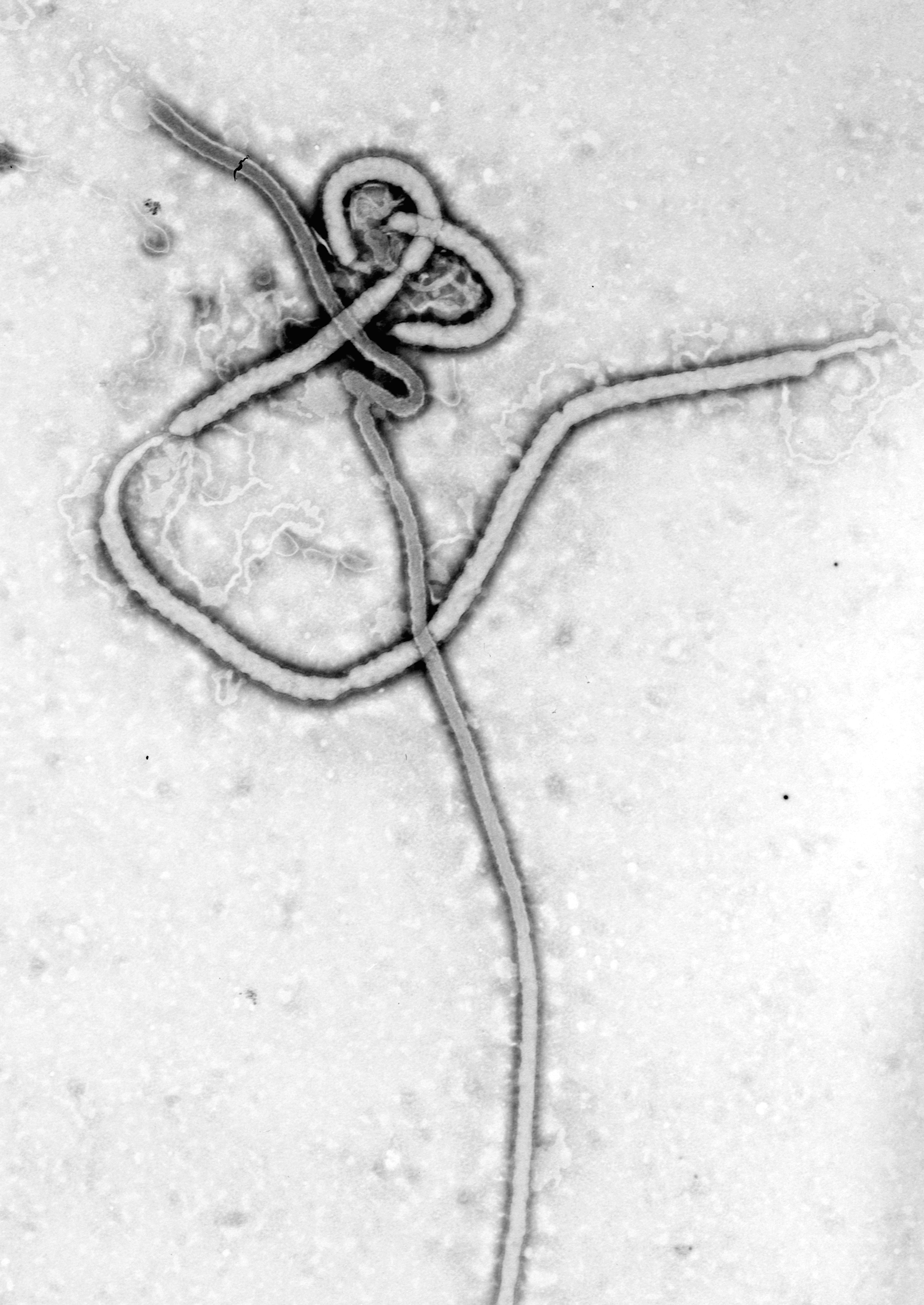  Virus Ébola (au microscope électronique) montrant la structure filamenteuse de la particule virale. Les filaments mesurent entre 60 et 80 nm de diamètre.