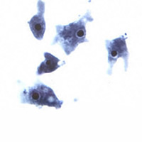  Naegleria fowleri forme trophozoïde