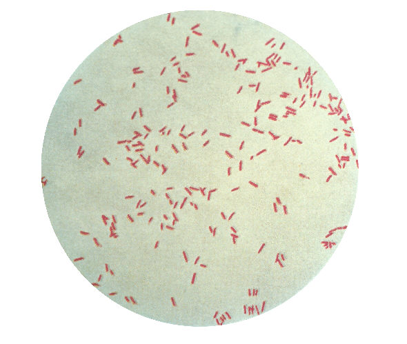  Pseudomonas aeruginosa en coloration de Gram