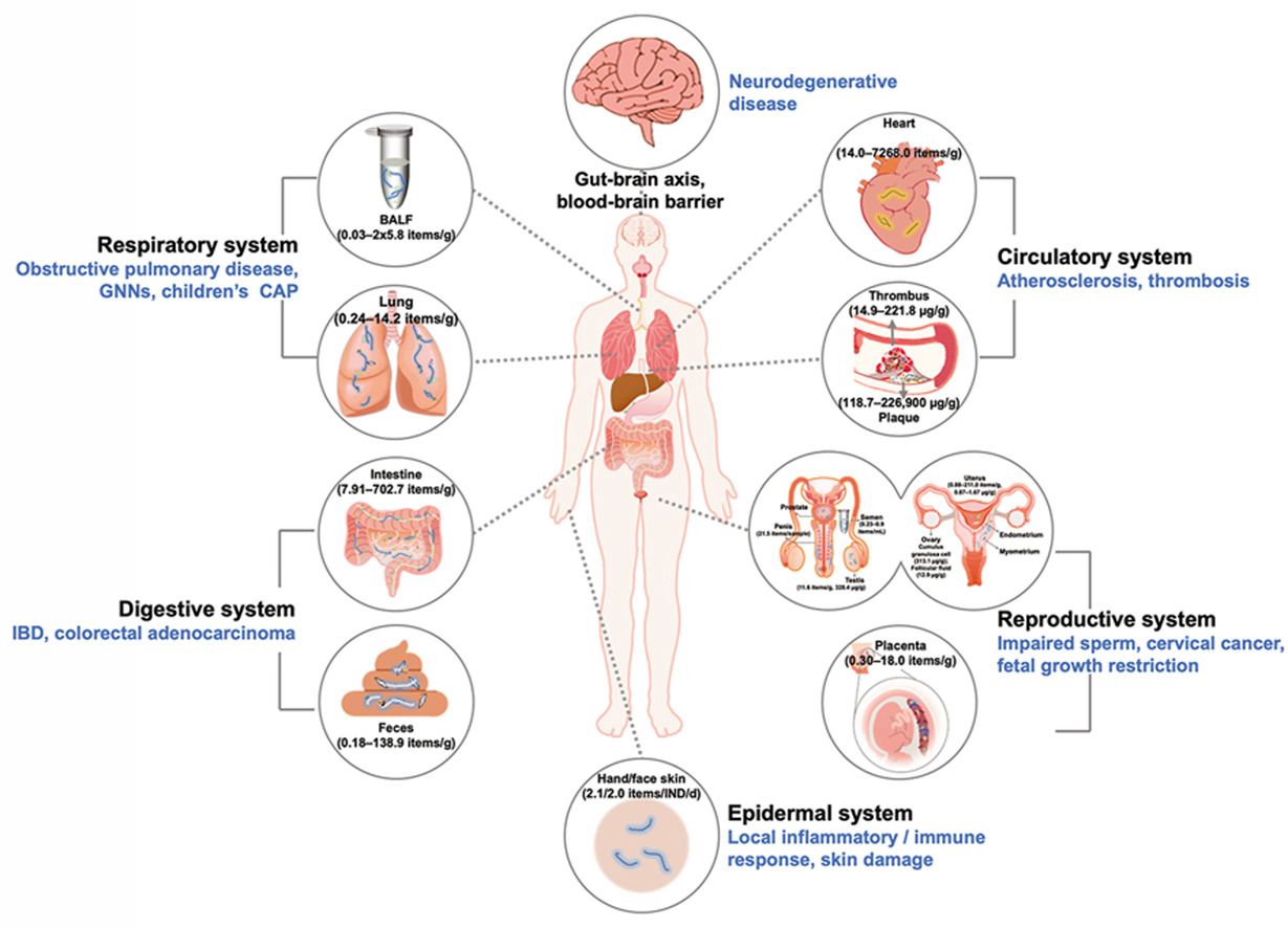 La corrélation alarmante entre microplastiques et maladies 