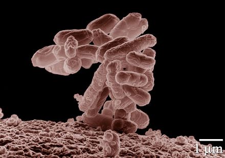 Découverte d'une nouvelle cible thérapeutique chez E. coli