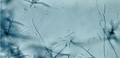 Le sol peut nous renseigner sur la résistance aux antibiotiques