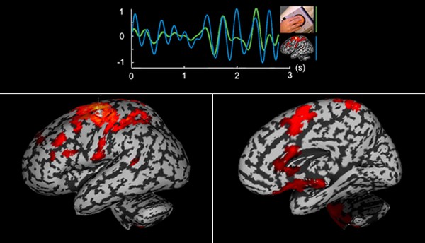 Observer le cerveau en action à la milliseconde près