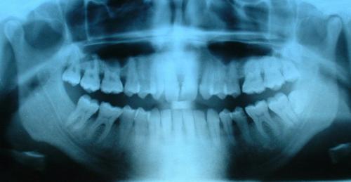 BasicMints: des bonbons pour des dents sans carie ?