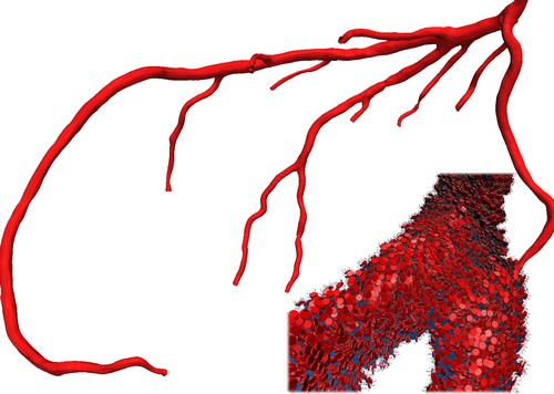Anticiper l'artèriosclérose grâce à un superordinateur