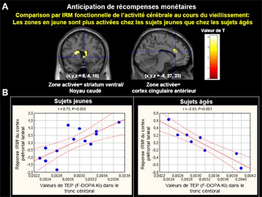 Fonctionnement et vieillissement du cerveau mieux compris