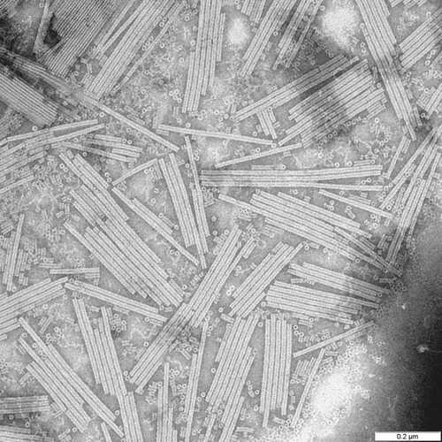 Un virus biologique pour accélérer les mémoires informatiques