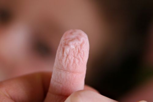 Pourquoi les doigts mouillés sont-ils ridés ?