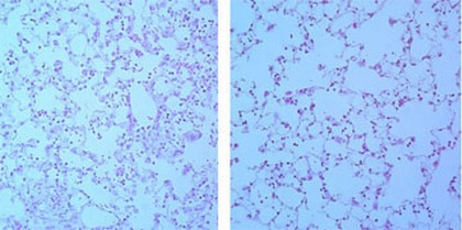 Nouvelles molécules anti-inflammatoires d'origine microbienne