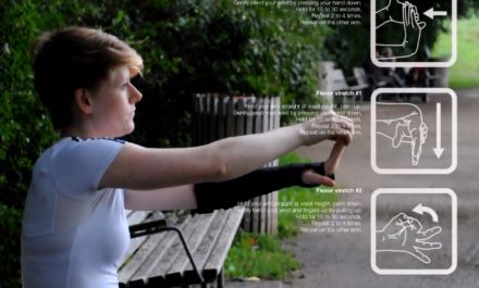 Bones, un plâtre high-tech