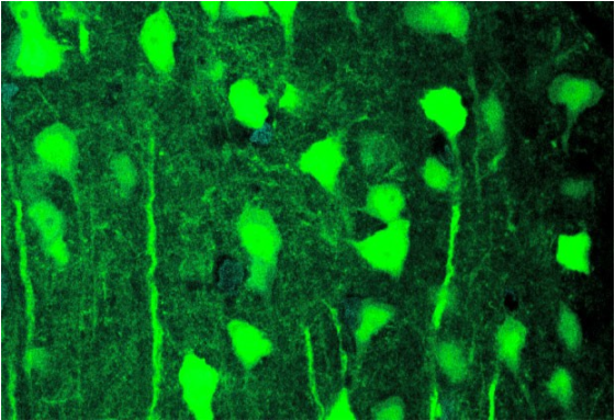 Une étude en neurosciences de Concordia montre comment inhiber un comportement conditionné