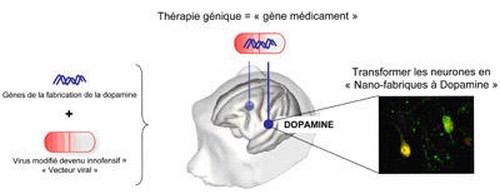 Succès d'un essai préclinique en thérapie génique dans la maladie de Parkinson
