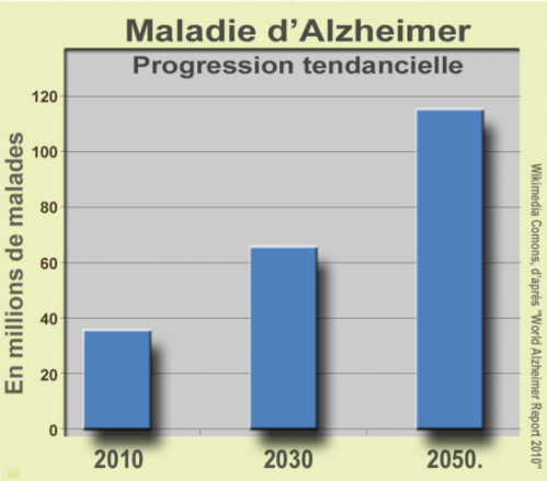 Maladie d'Alzheimer : pourquoi la personne ne reconnaît plus ses proches?