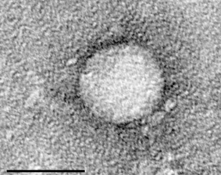 Nouveaux tests pour le dépistage de l'hépatite C