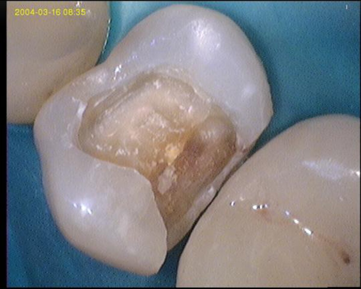Odontologie conservatrice