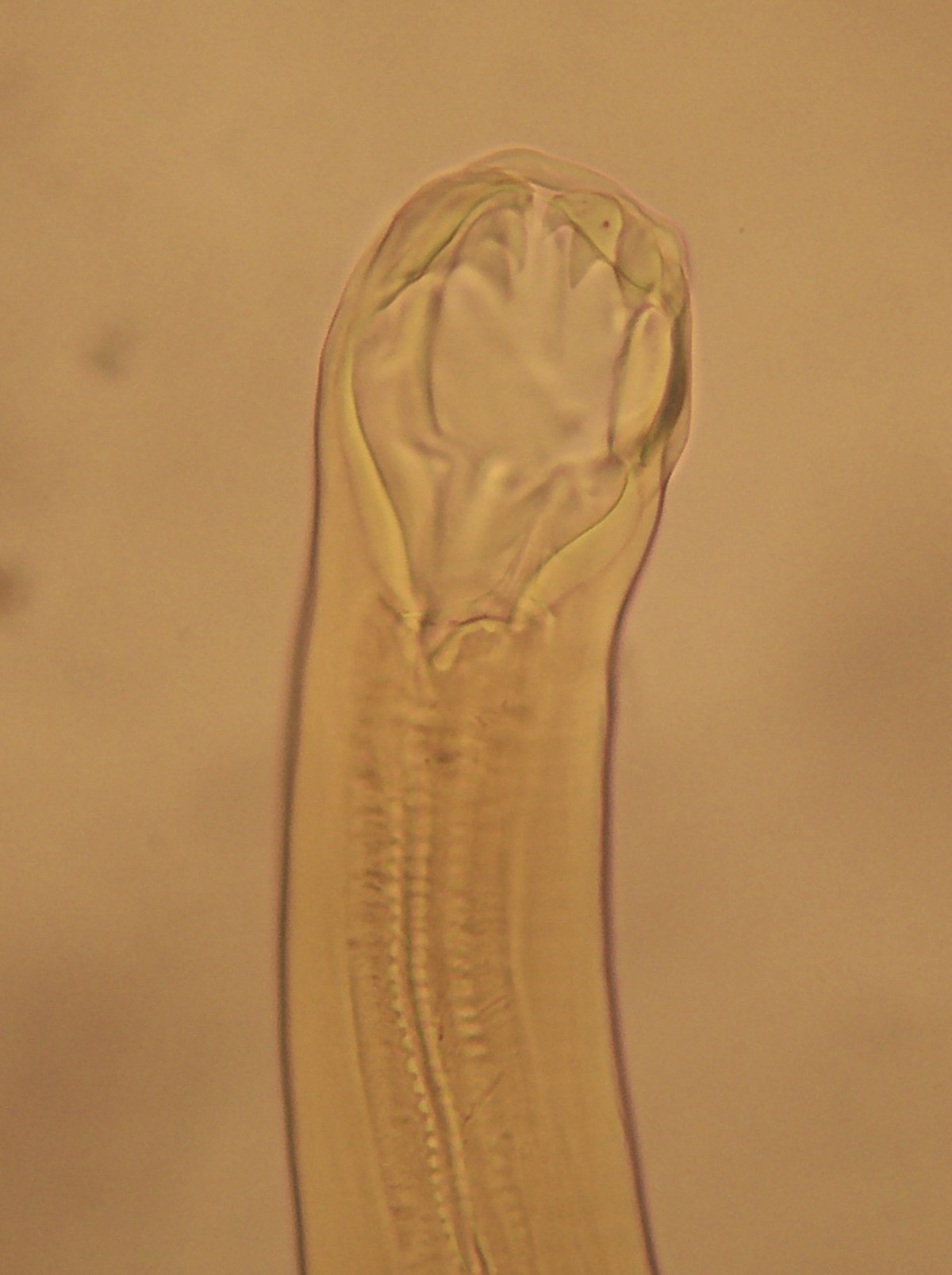 Ankylostoma duodenale