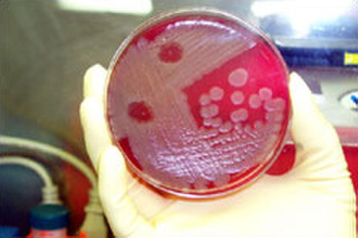 Une culture de Bacillus anthracis