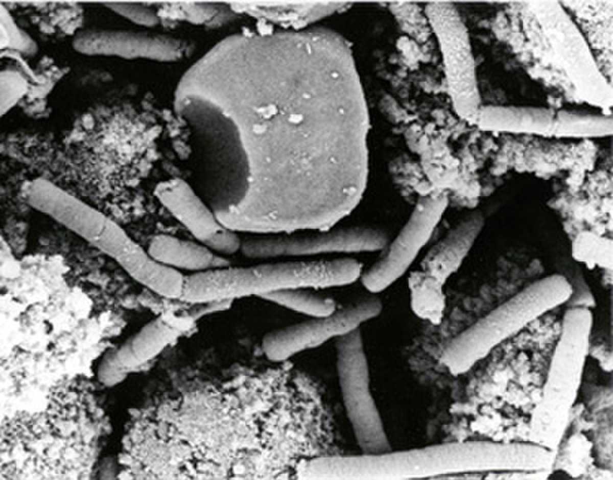 Bacillus anthracis