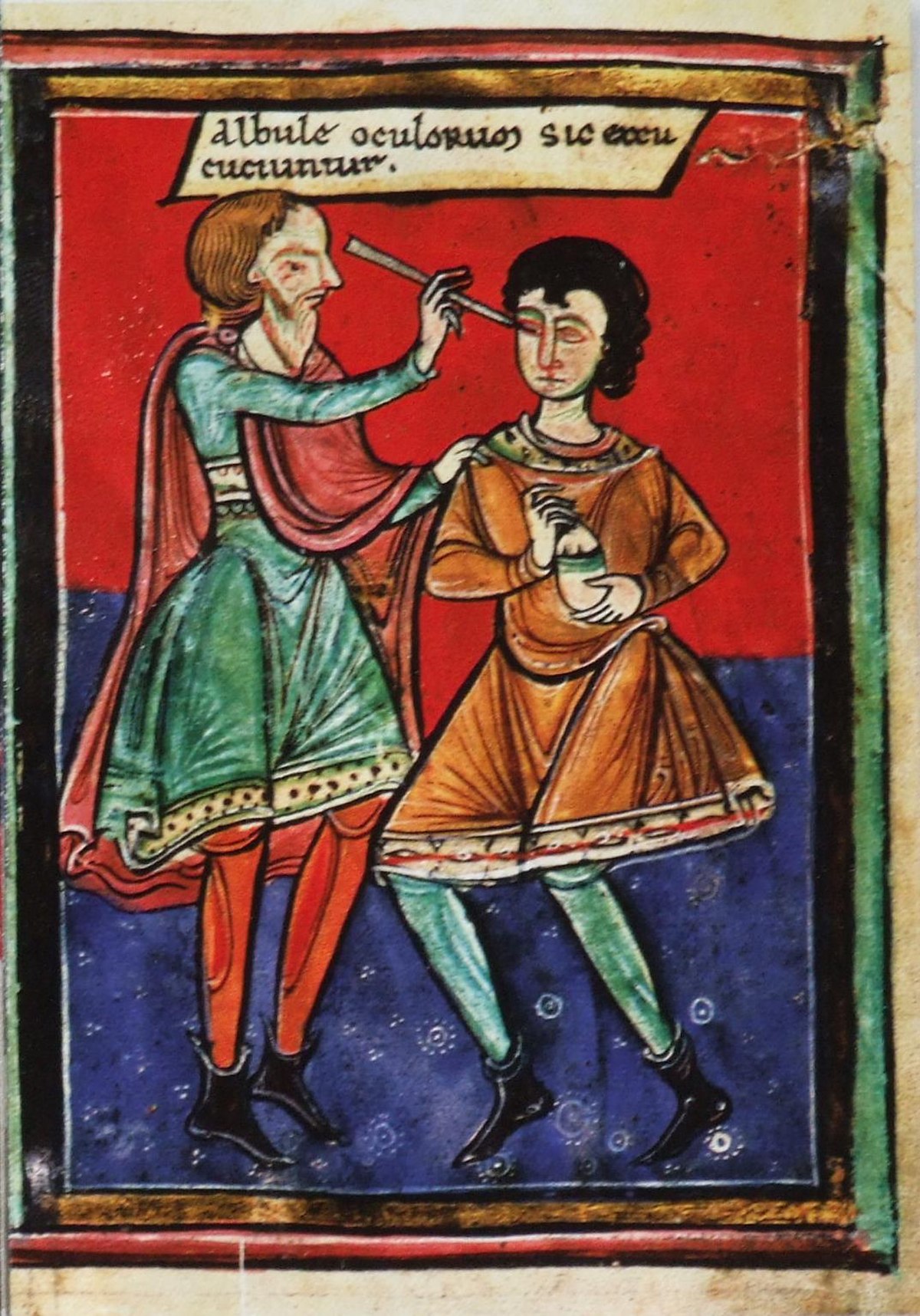 Chirurgie oculaire
