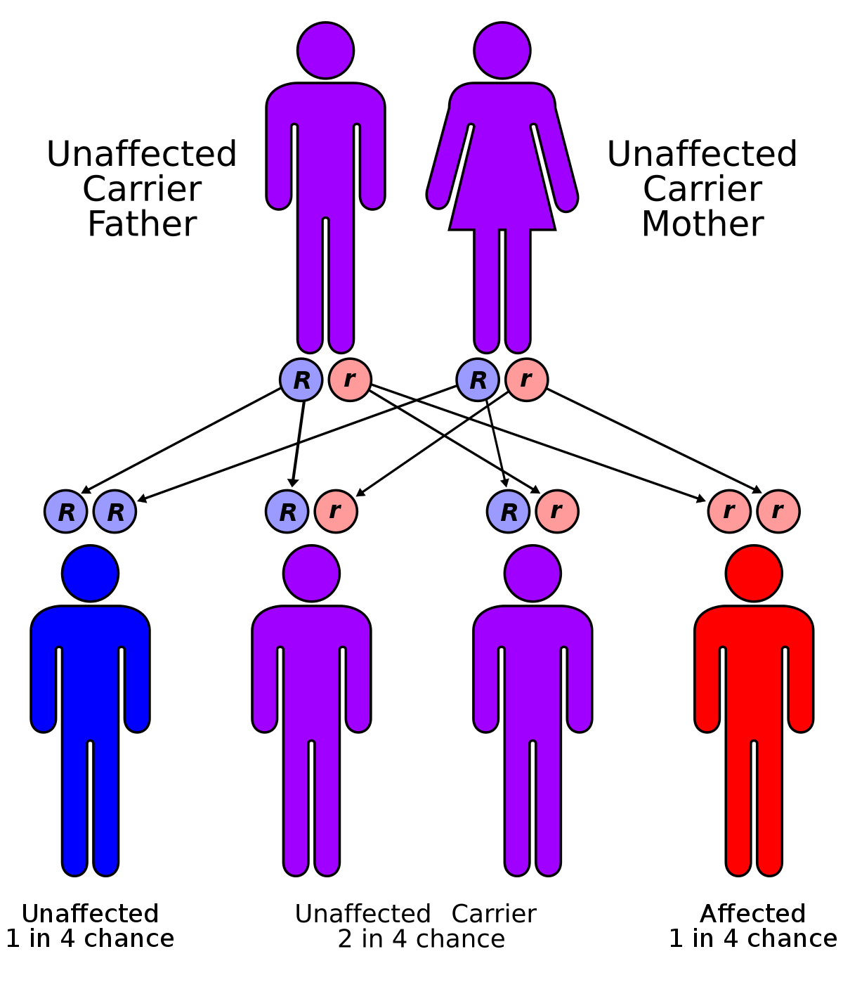 Situs inversus