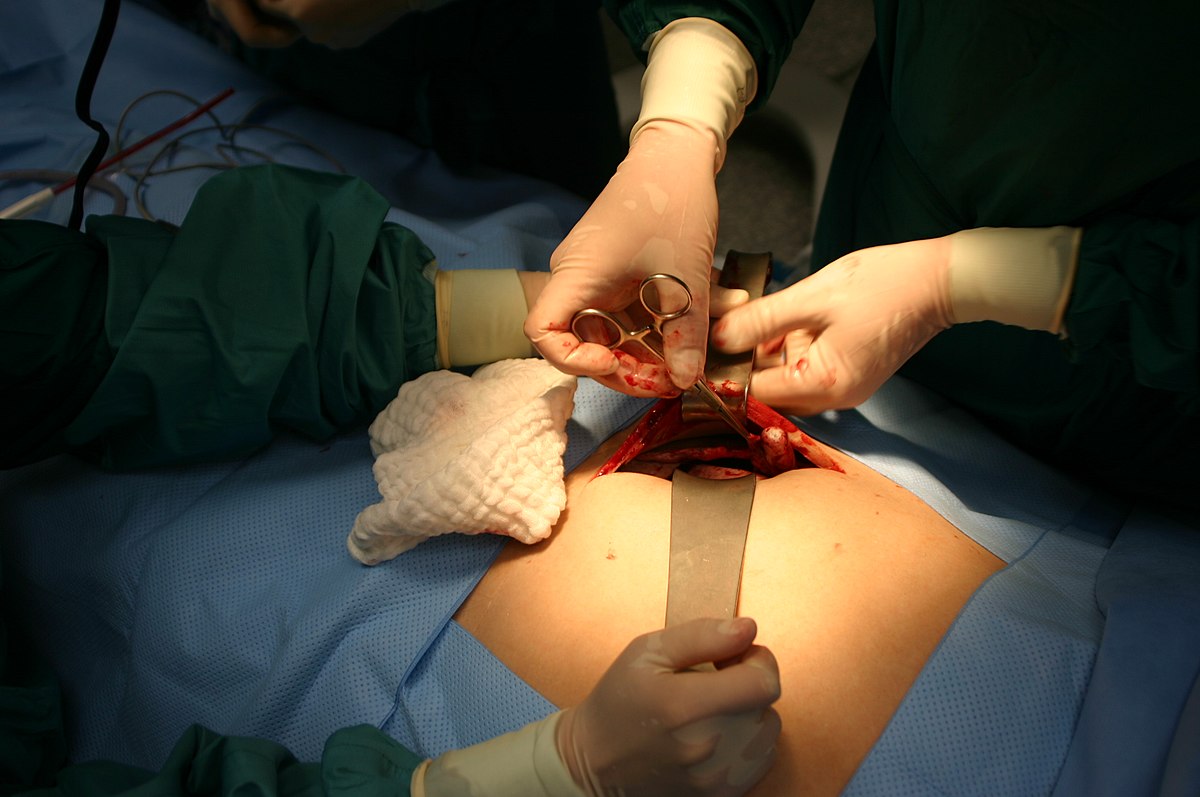 Côlon (anatomie)