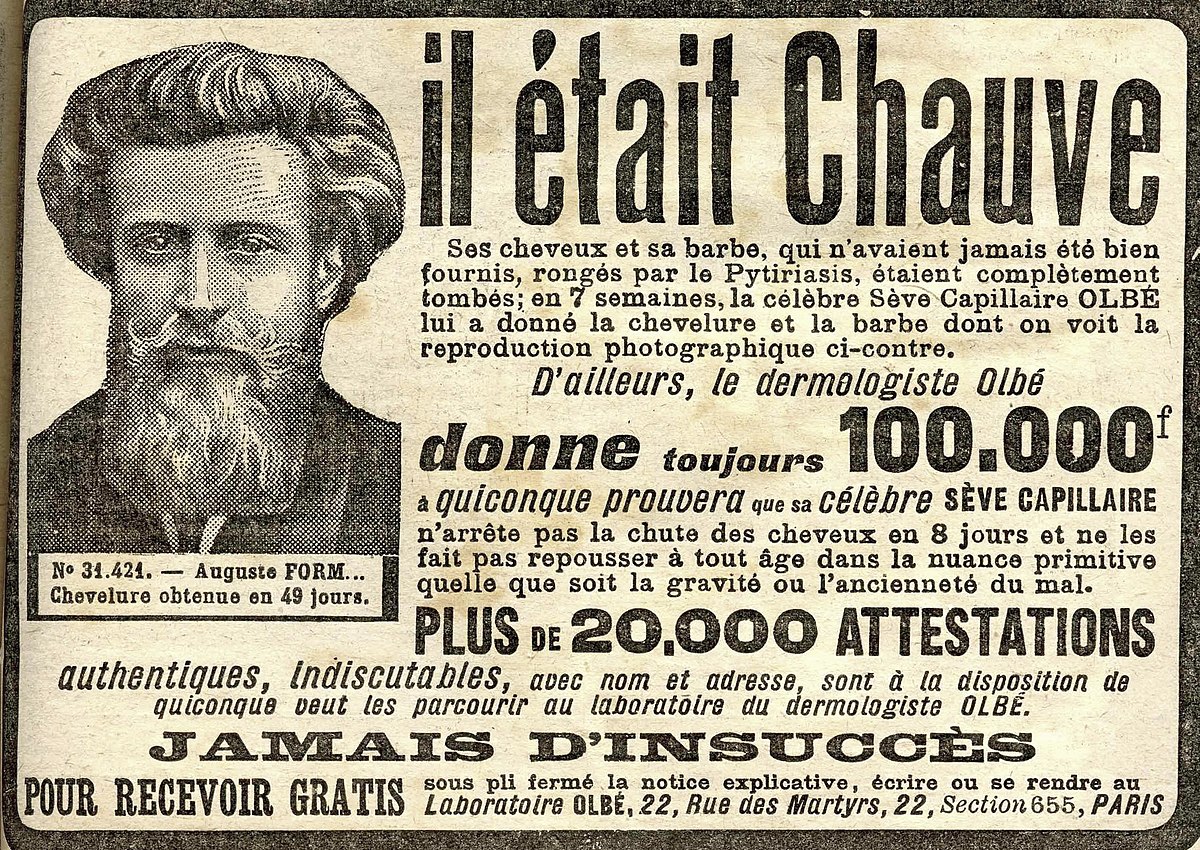 Alopécie