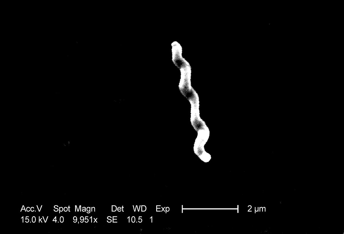 Photographie au microscopie électronique deCampylobacter jejuni