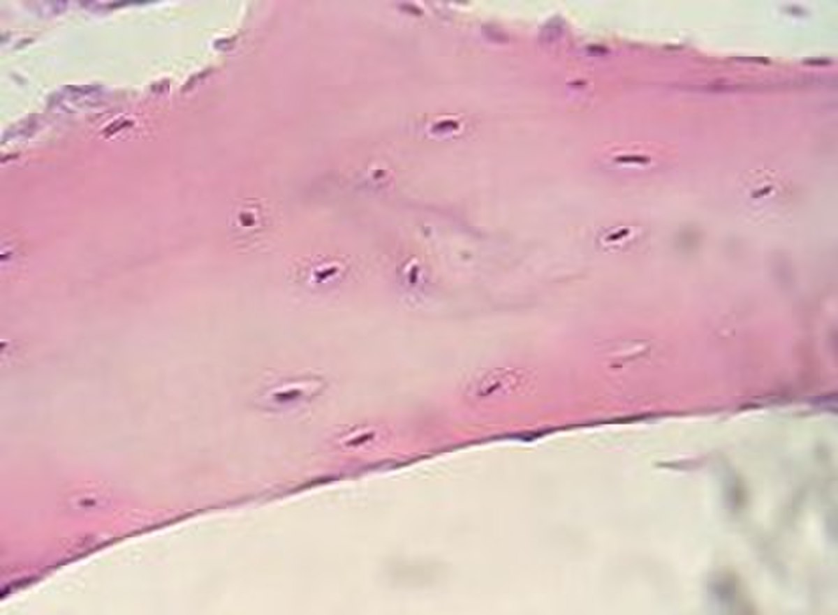 Cartilage