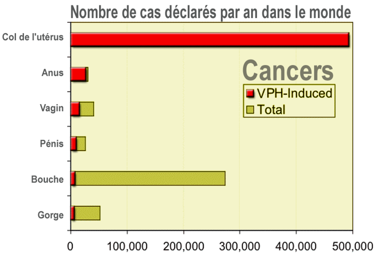Cancer du col utérin