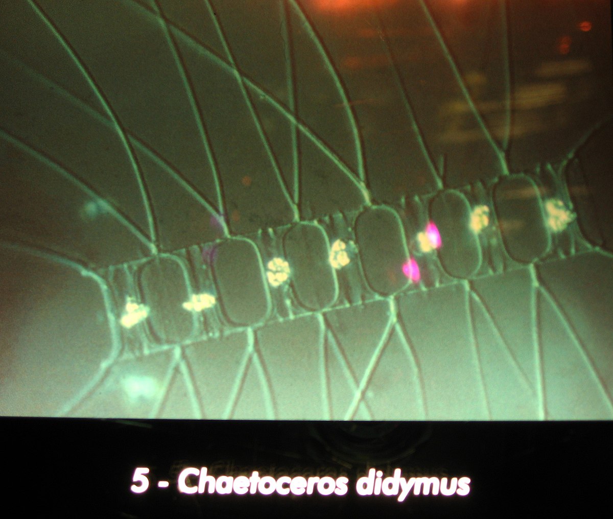 Chaetoceros