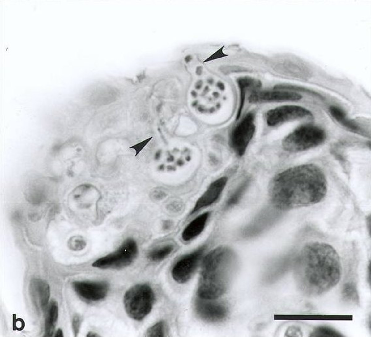 Chytridiomycota (classification phylogénétique)