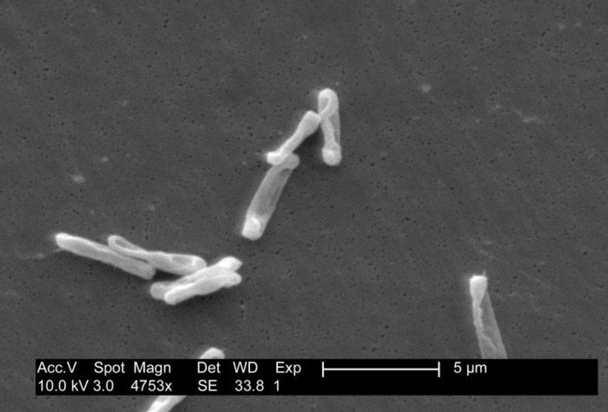 Clostridium difficile