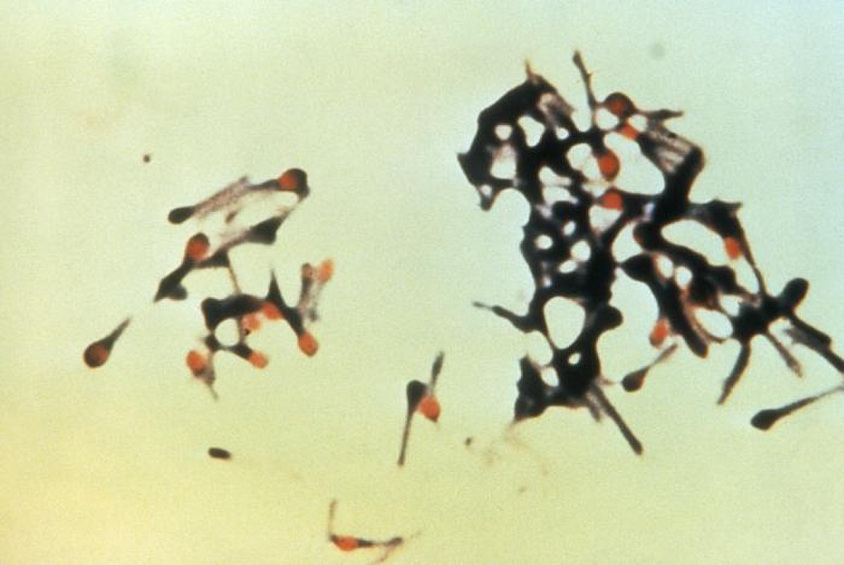 Clostridium