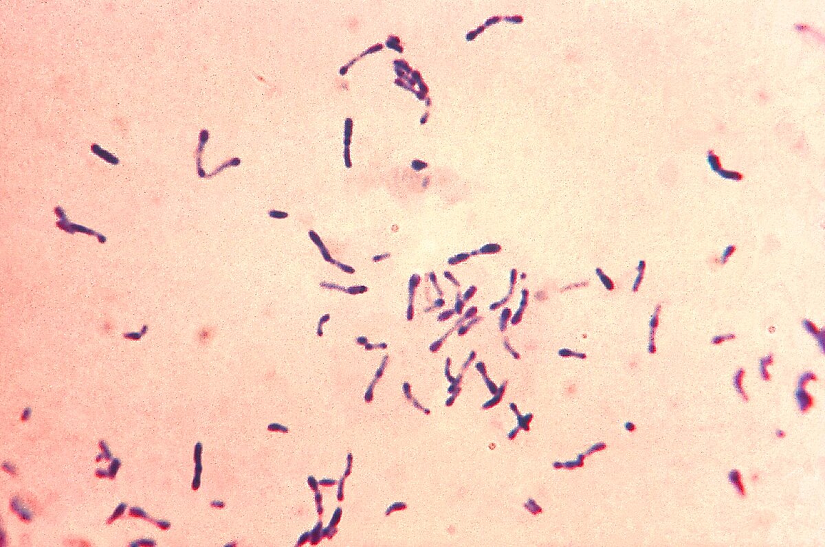 Diphtérie