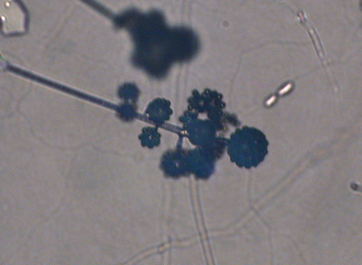 Zygomycota (classification phylogénétique)