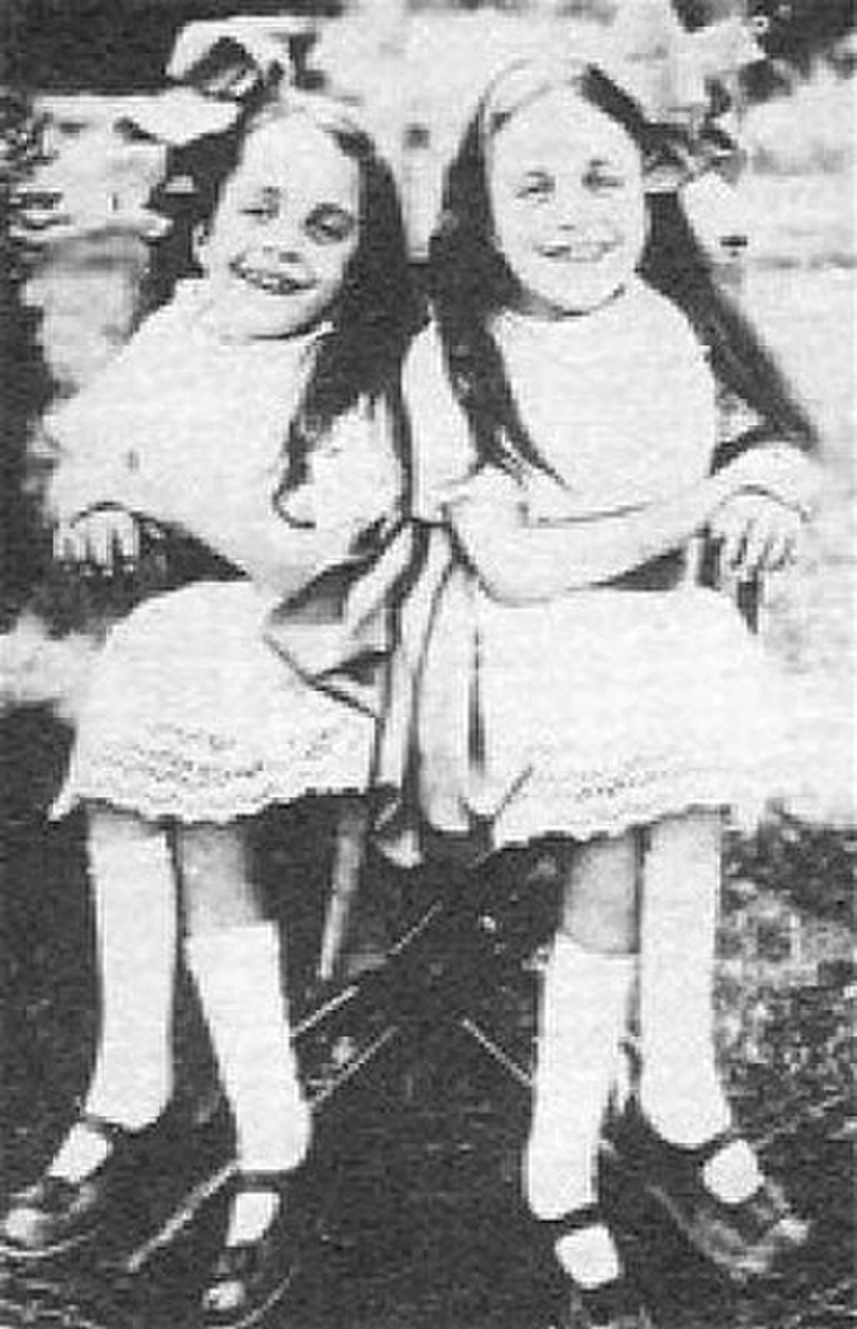 Frères siamois