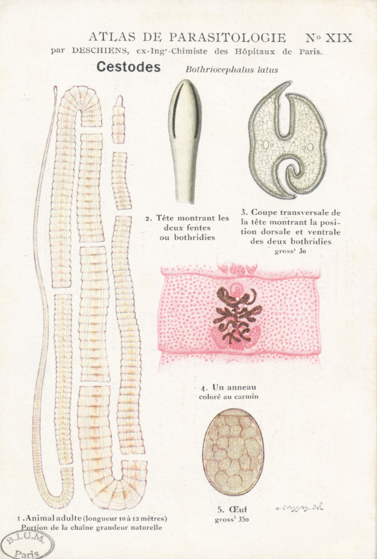 Diphyllobothrium latum