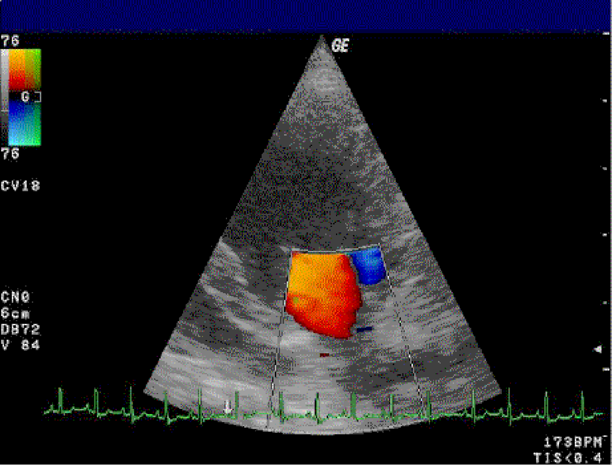 Échocardiographie